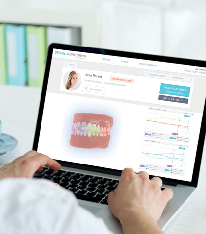 Dental monitoring